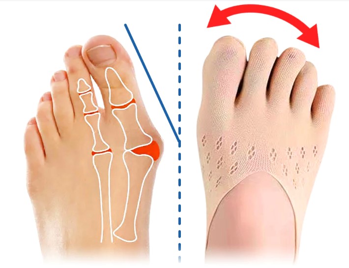 Calcetines Anti-juanetes